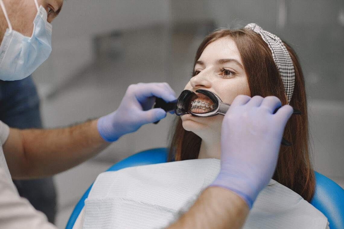 Quel Est Le Co T Moyen D Un Traitement D Orthodontie Pour Les Adultes